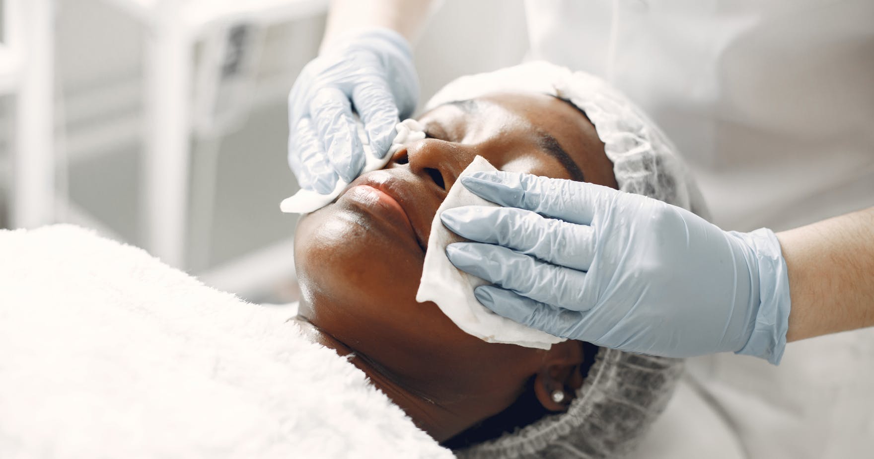 A female patient receiving chemical peel treatment