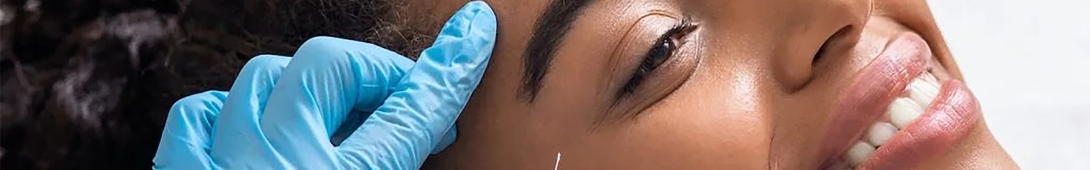 Female patient receiving anti wrinkle injections