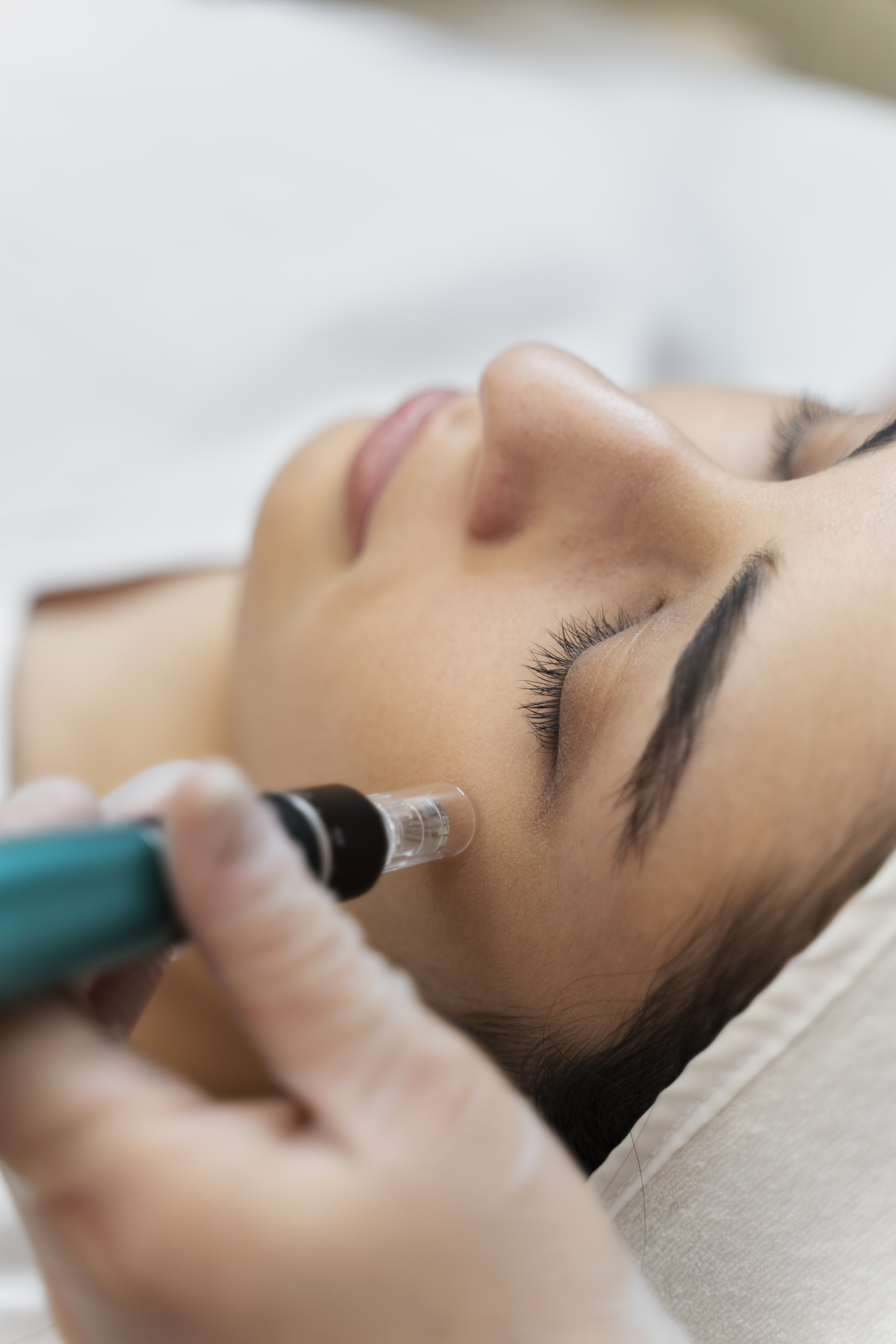 CNC Micro Needling PRO