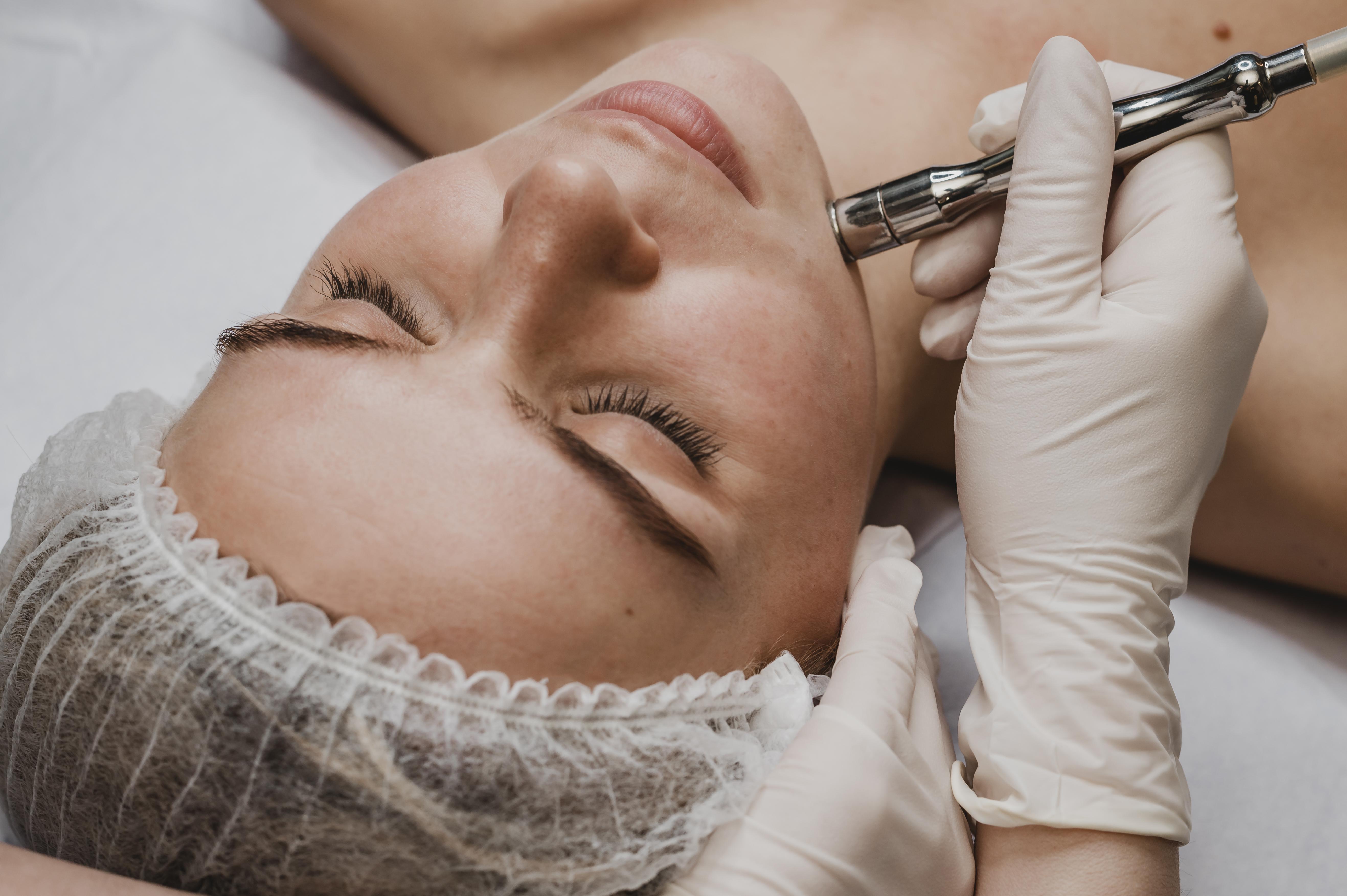 Microdermabrasion | 60 min - 5 einheiten + 1 gratis