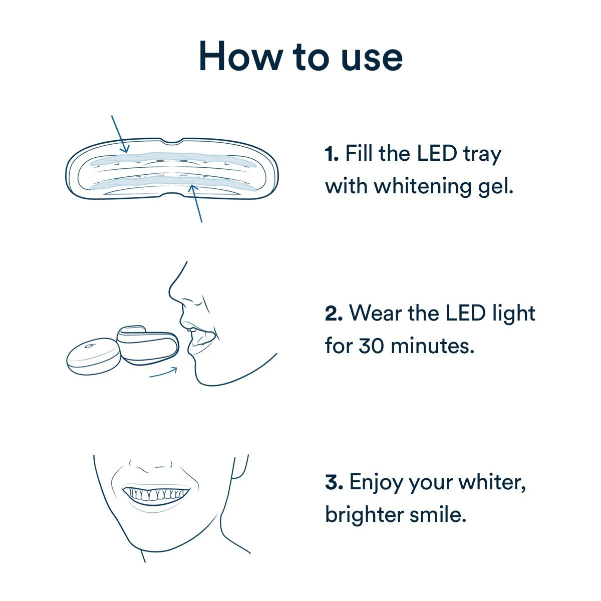 Teeth Whitening Kit Auraglow