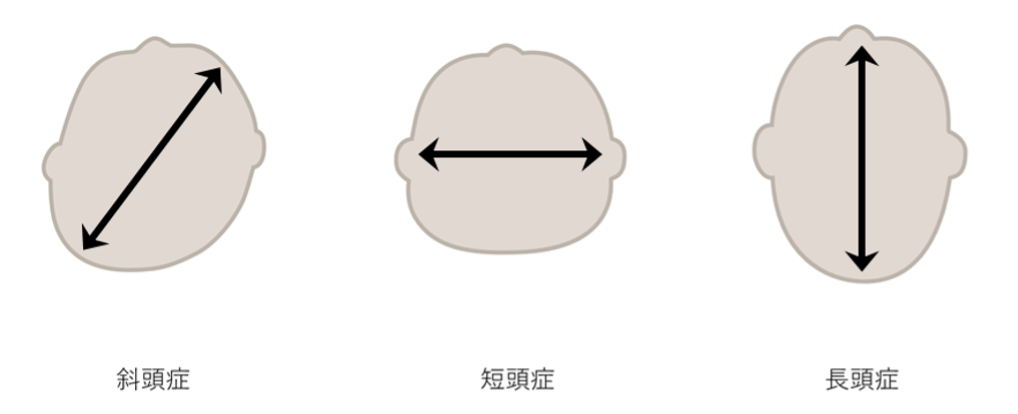 head shape type
