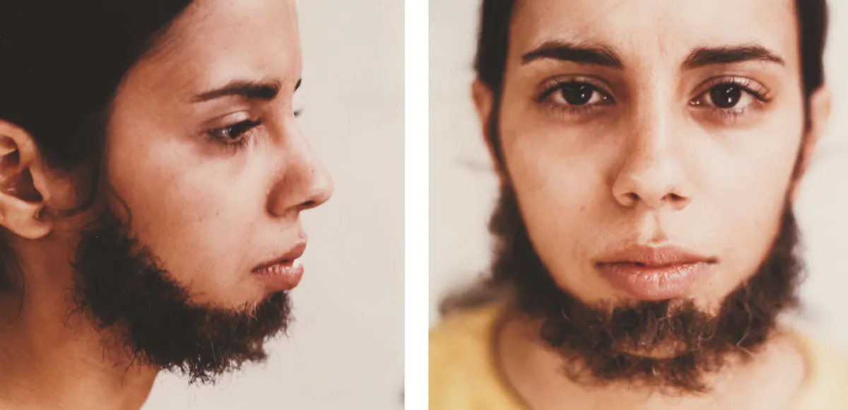 Ana Mendieta, Untitled (Facial Hair Transplants), 1972. Foto © The Estate of Ana Mendieta LLC, Courtesy Galerie Lelong & Co (dettaglio)