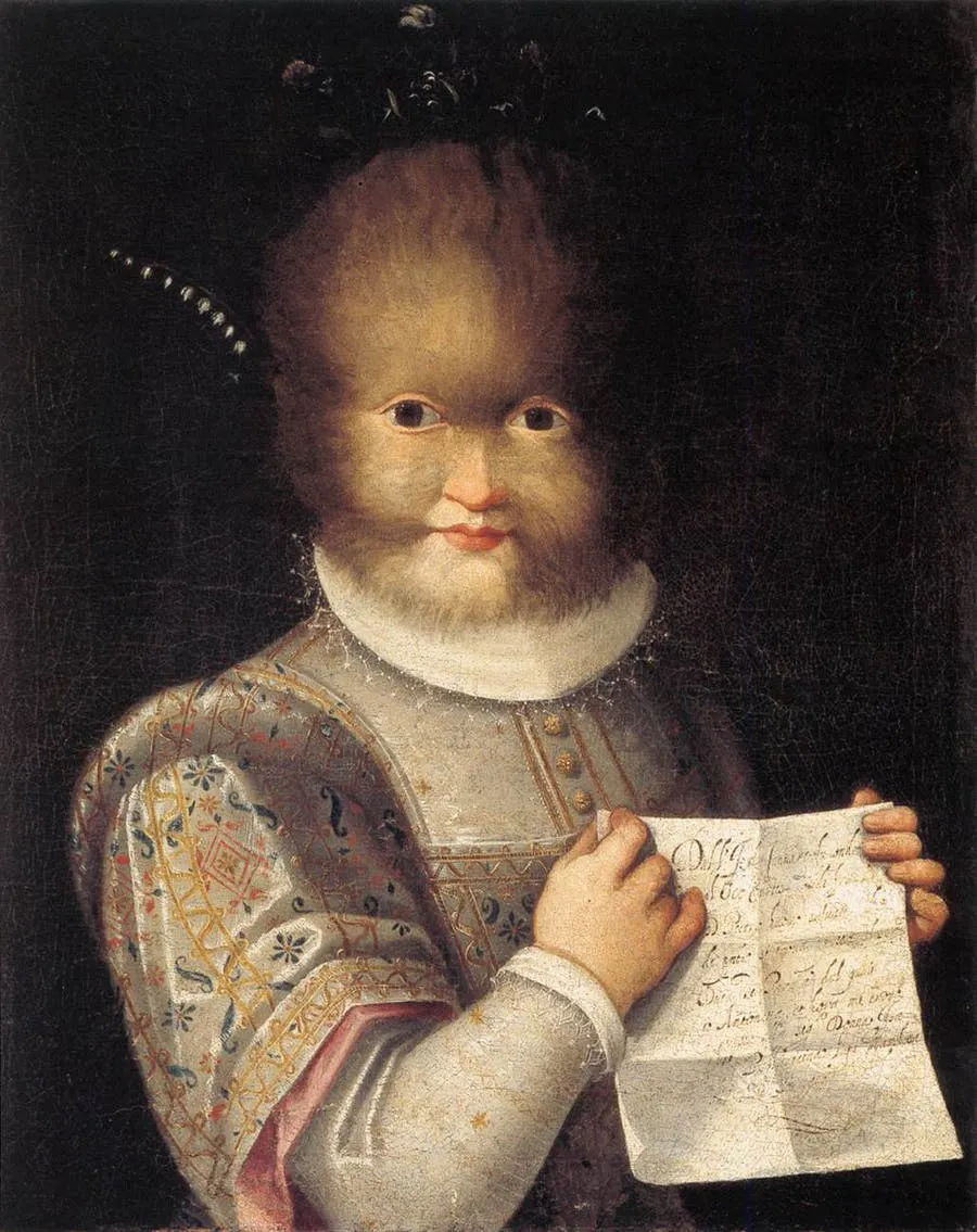 Lavinia Fontana (1552–1614), Bildnis der Antonietta "Tognina" Gonsalvus, ca. 1594/95, Öl/Holztafel, 57 x 46 cm, Château de Blois. Foto gemeinfrei