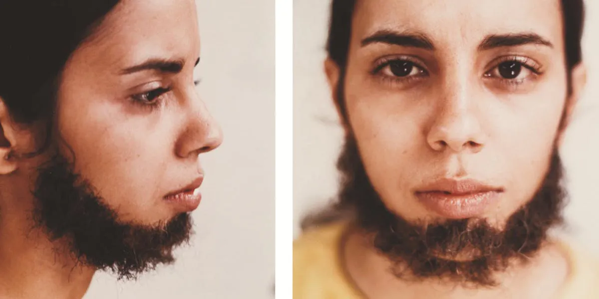 Ana Mendieta, Untitled ((Facial Hair Transplants), 1972. Photo © The Estate of Ana Mendieta LLC, Courtesy Galerie Lelong & Co