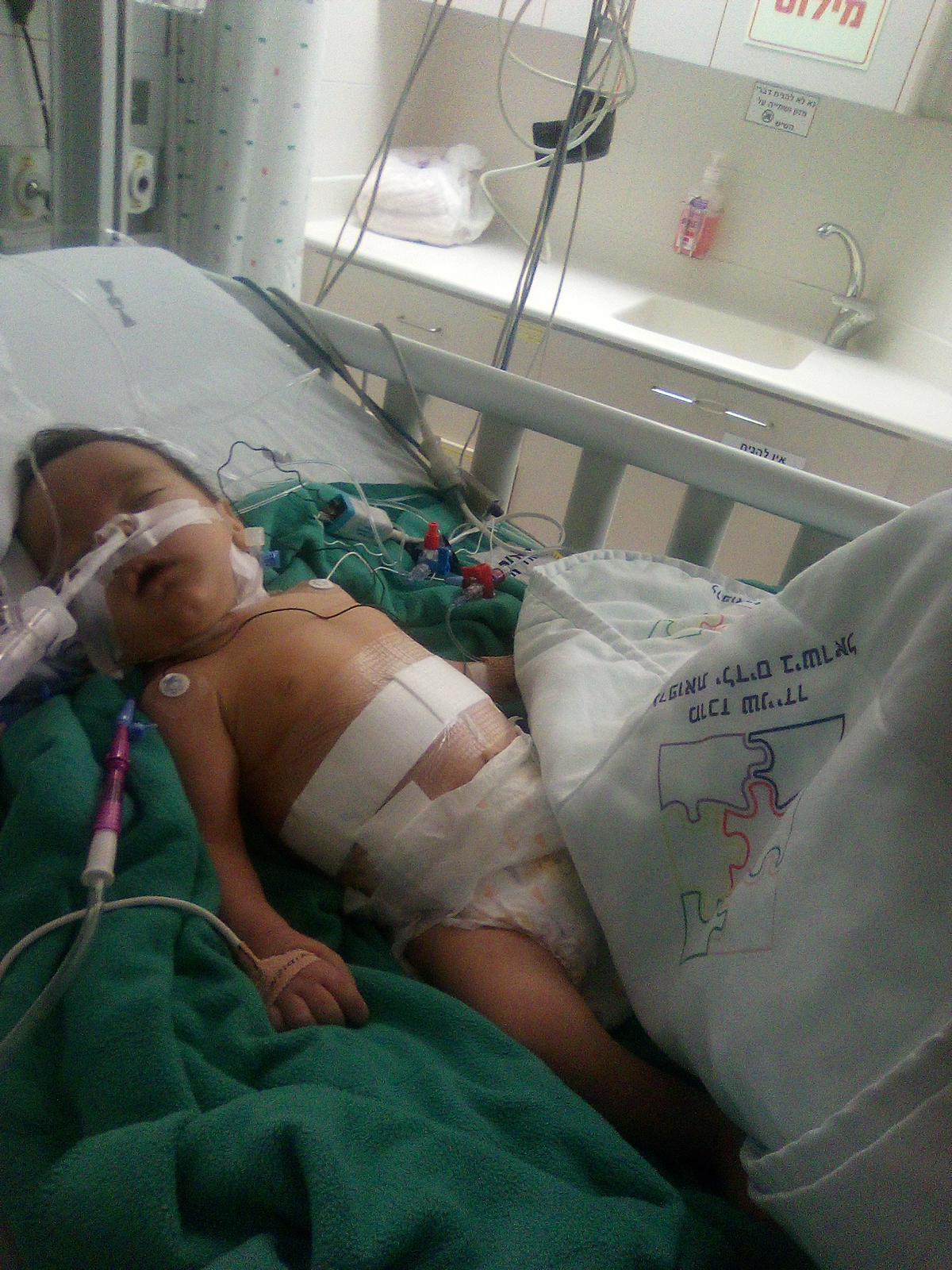 Penina Shira attached to tubes and wires in a hospital bed