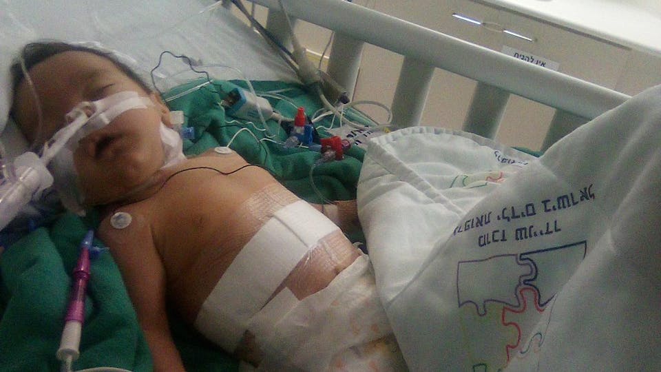 Penina Shira attached to tubes and wires in a hospital bed