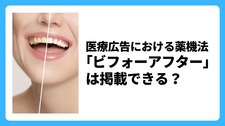医療広告における薬機法「ビフォーアフター」は掲載できる?