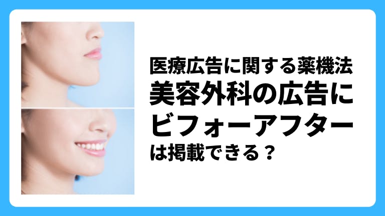 医療広告に関する薬機法 美容外科の広告にビフォーアフターは掲載できる?