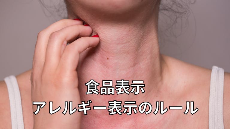 食品表示 アレルギー表示のルール