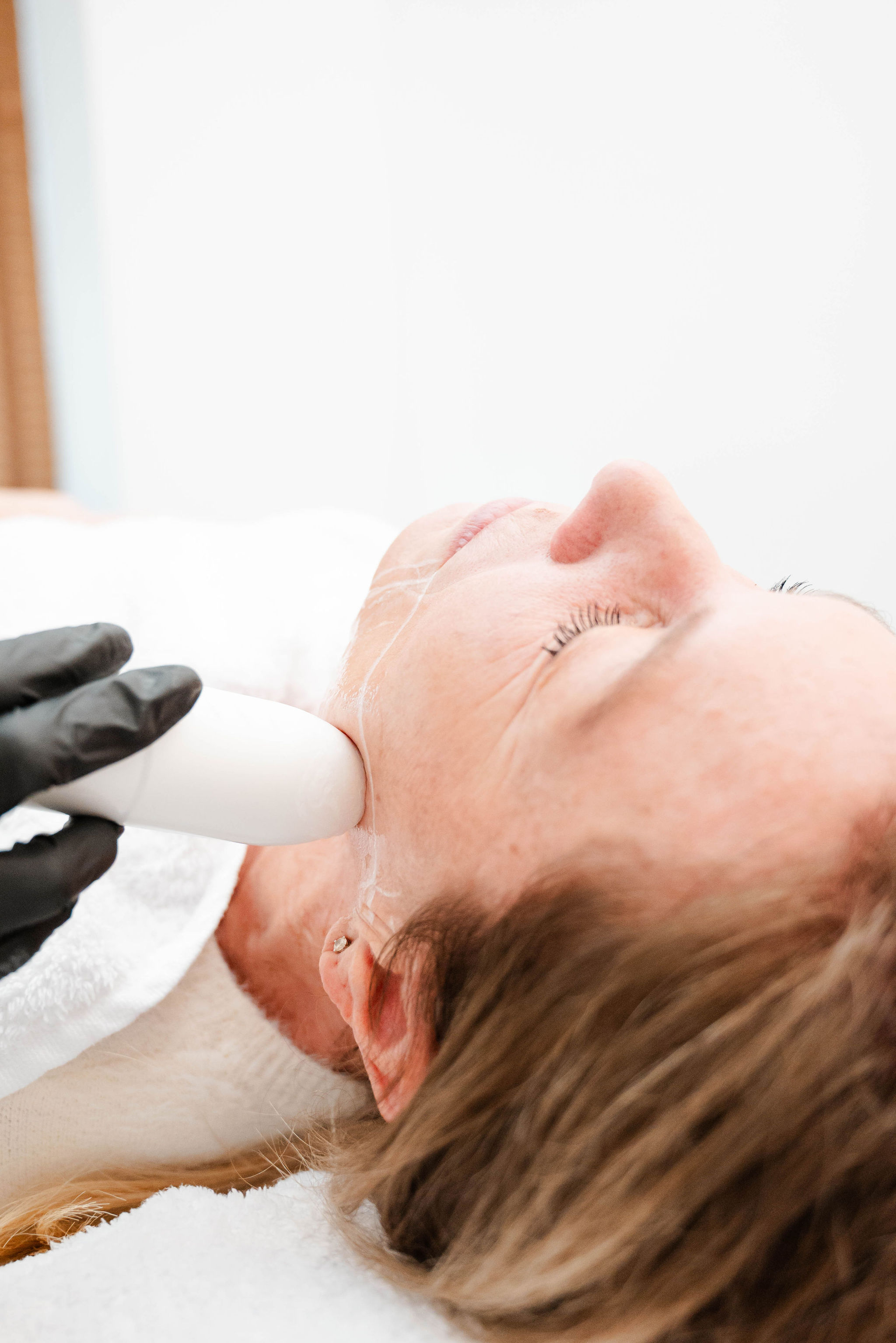 Een klant ondergaat een HIFU-gezichtsbehandeling voor huidversteviging en verjonging, uitgevoerd door een professional in een ontspannen omgeving.