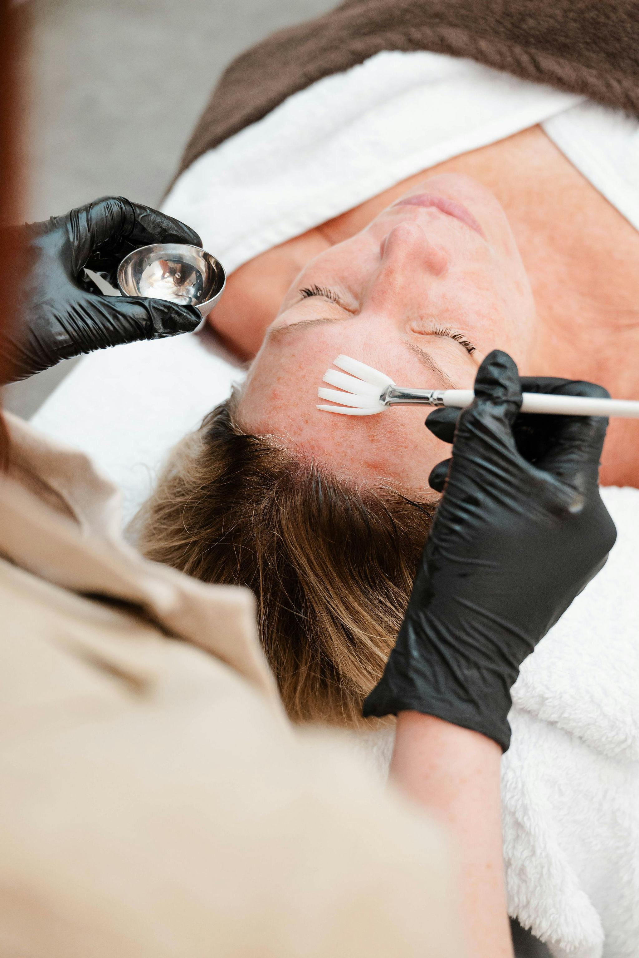 Werkt tegen pigment, pigmentatie, pigmentvlekken, rimpels, verslapping, acn&eacute;, puistjes