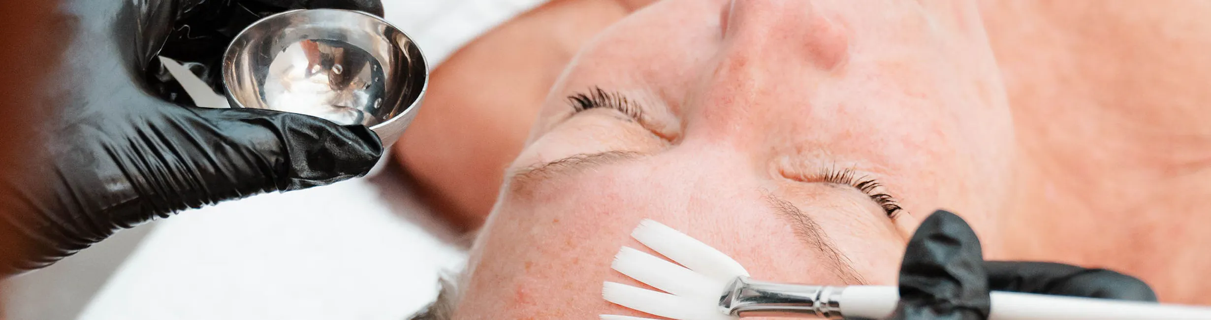 Werkt tegen pigment, pigmentatie, pigmentvlekken, rimpels, verslapping, acné, puistjes