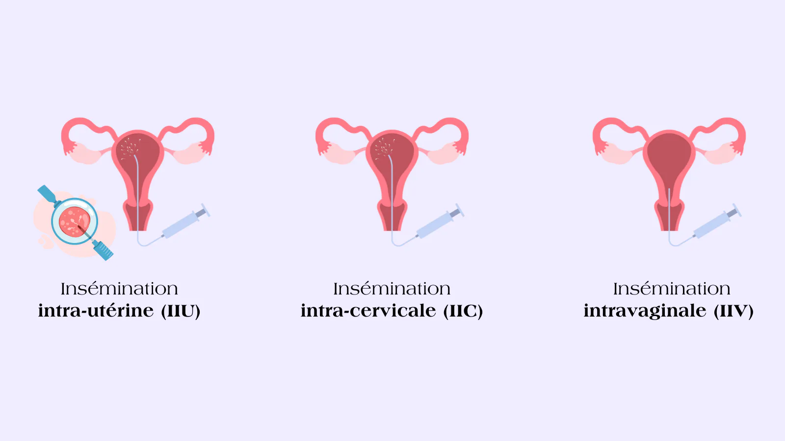 schema de l’insémination artificielle
