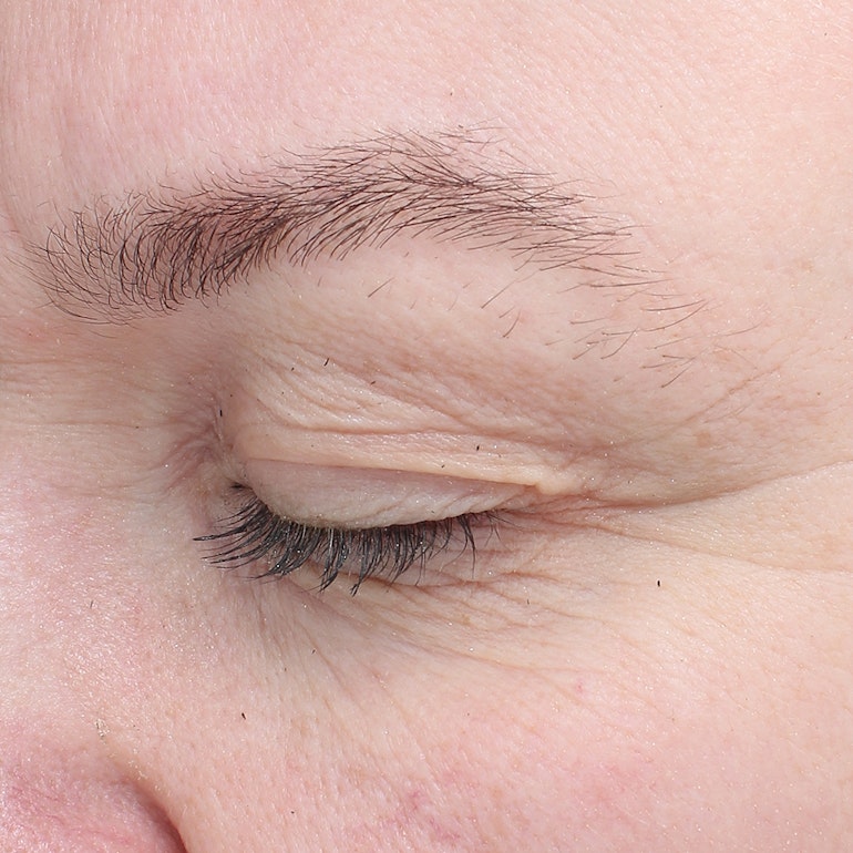 Before picture of the anti aging Bioeffect EGF Eye Serum for fine lines and wrinkles