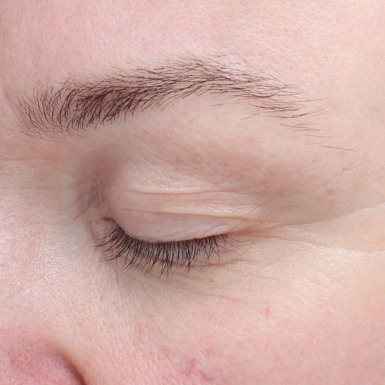 After picture of the anti aging Bioeffect EGF Eye Serum for fine lines and wrinkles