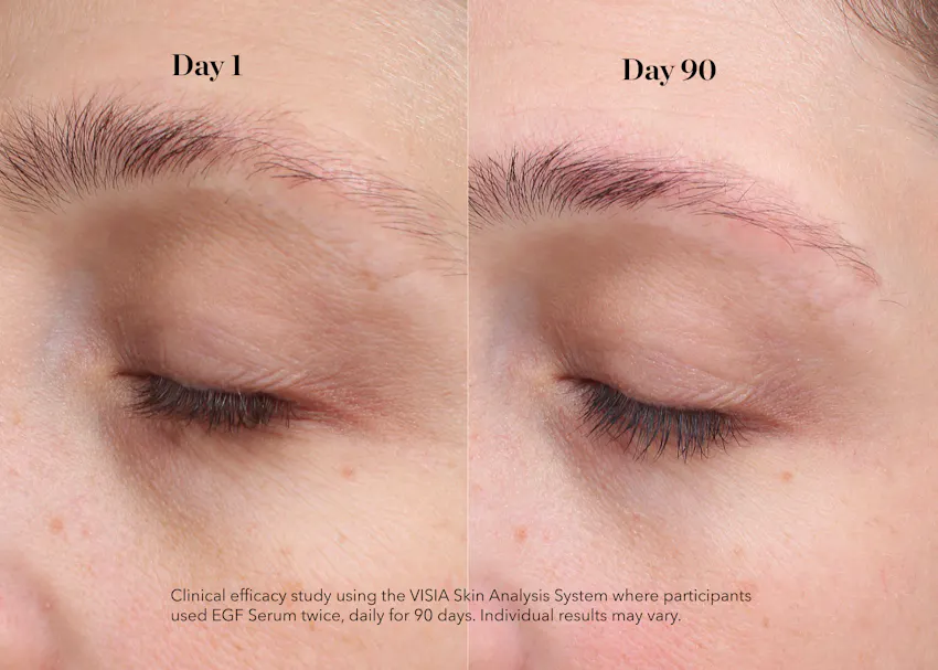 Before and after comparison showing the eye area after 90 days of use, illustrating visibly smoother skin texture and reduced appearance of fine lines.