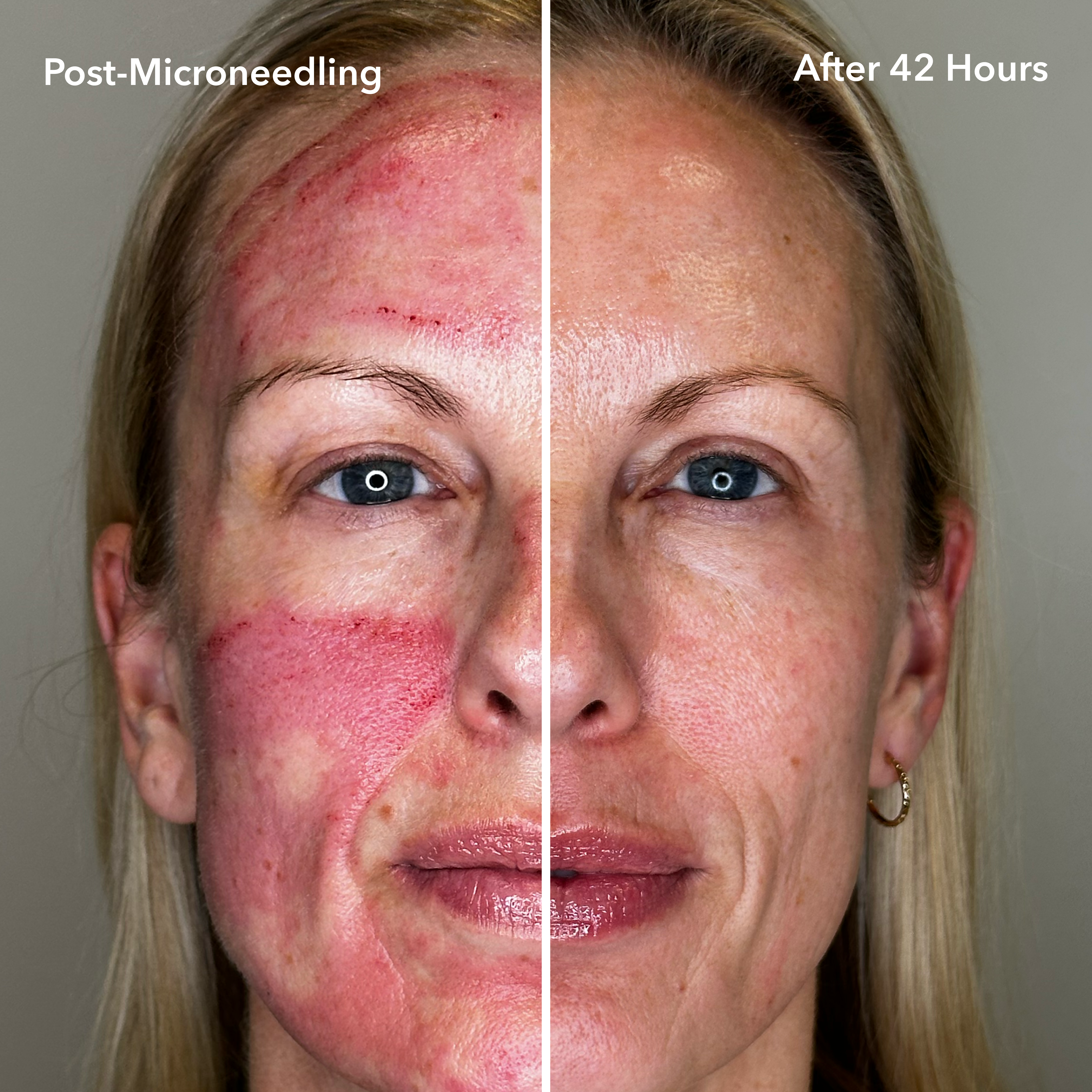 Rave Reviews: People Who Love the 30 Day Treatment.