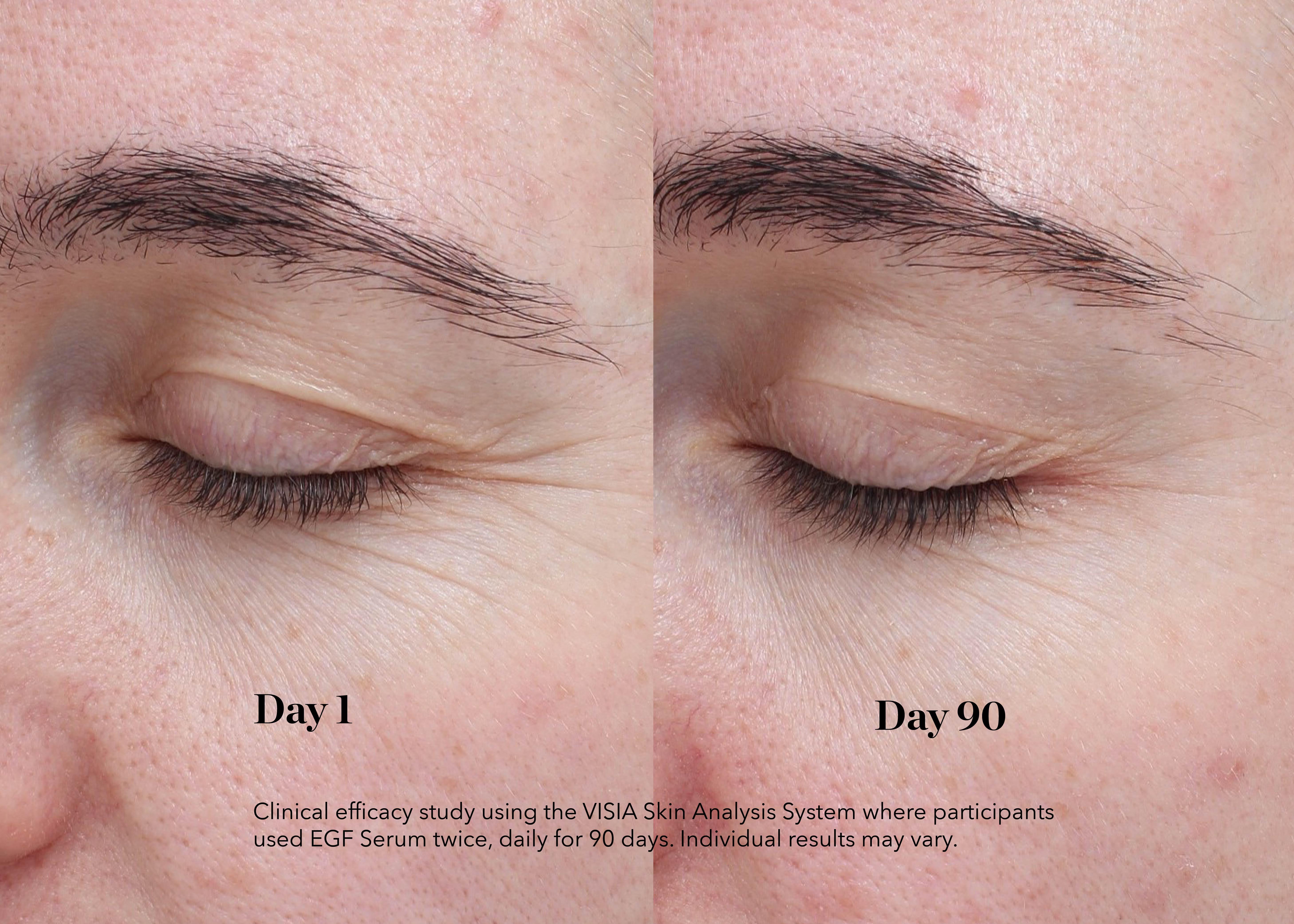 EGF Day Serum | Anti-Wrinkle Face Serum | BIOEFFECT