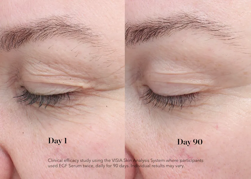 Before and after comparison showing improvement in fine lines around the eye area after 90 days of using BIOEFFECT EGF Day Serum