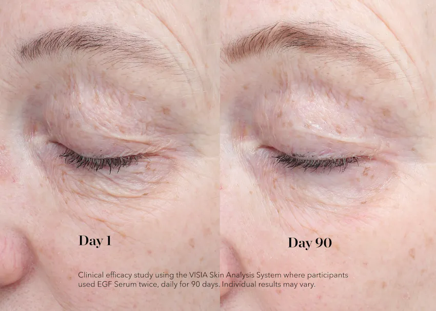 Before and after comparison showing visible improvement in fine lines, wrinkles, and skin texture around the eye area after 90 days of using BIOEFFECT EGF Power Cream