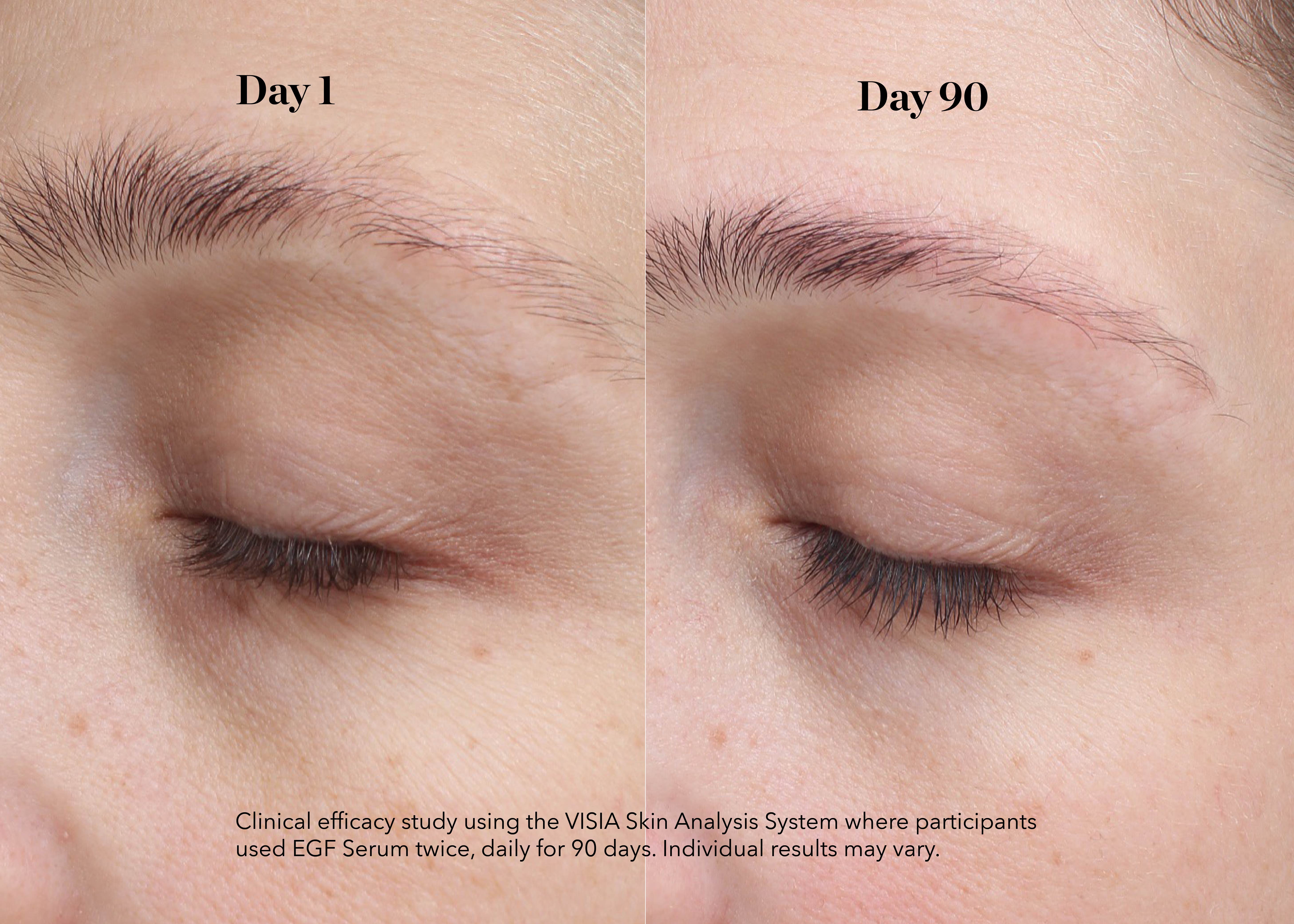 EGF Power Eye Cream | Growth Factor Eye Cream | BIOEFFECT