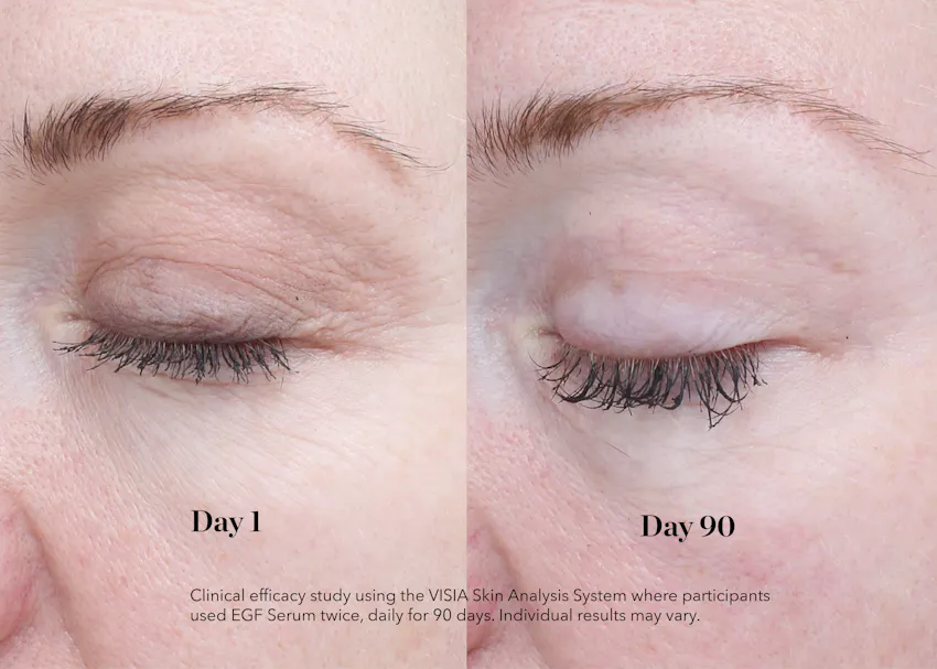 Before and after comparison showing improvement in fine lines around the eye area after 90 days of using BIOEFFECT EGF Power Serum