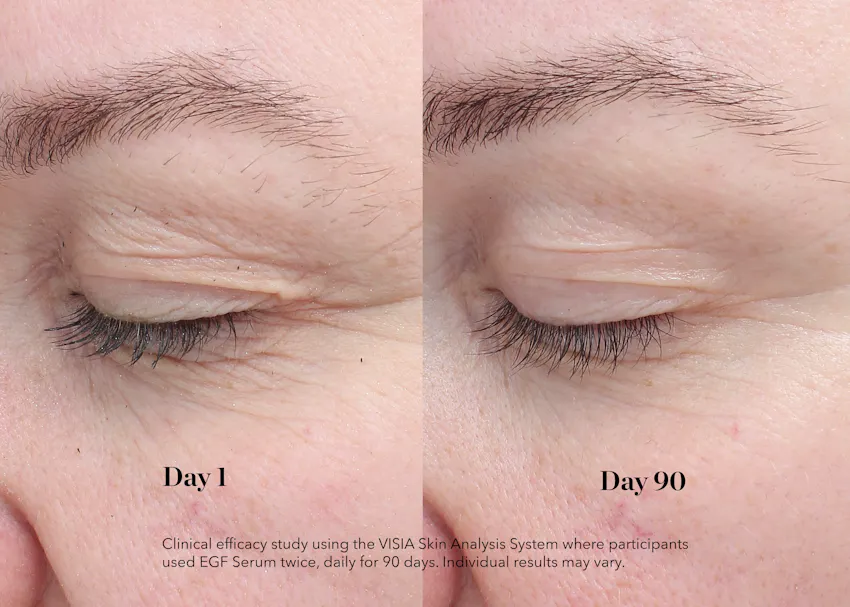 Before and after comparison showing improvement in fine lines around the eye area after 90 days of using BIOEFFECT EGF Eye Serum