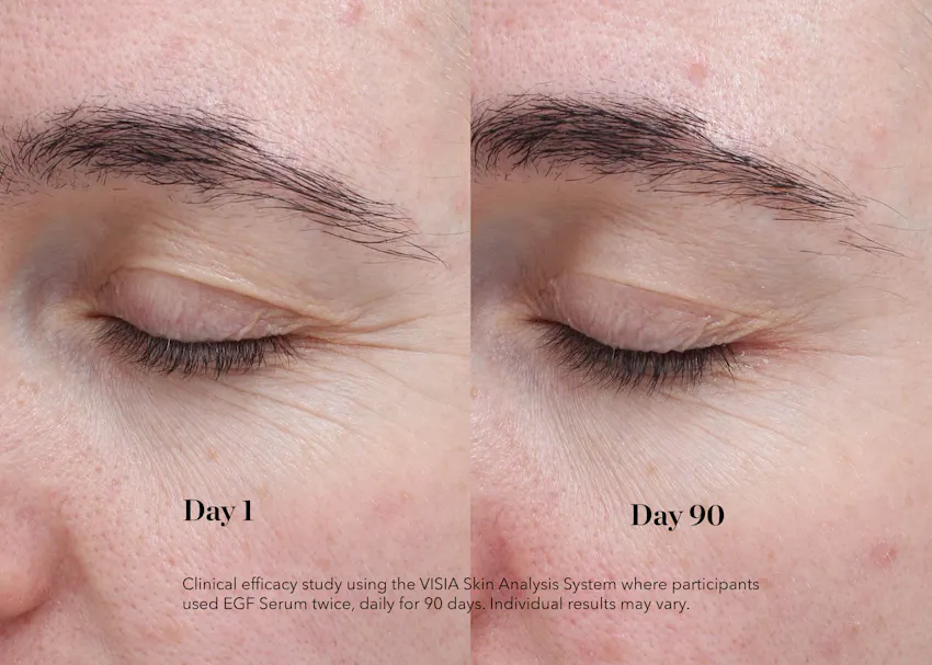 Before and after comparison showing improvement in fine lines around the eye area after 90 days of using BIOEFFECT EGF Day Serum