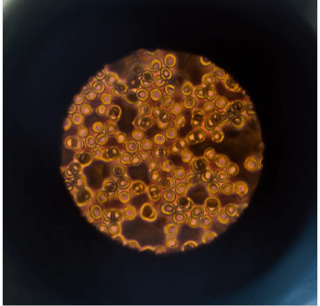 Microscope imagery of fungal spores