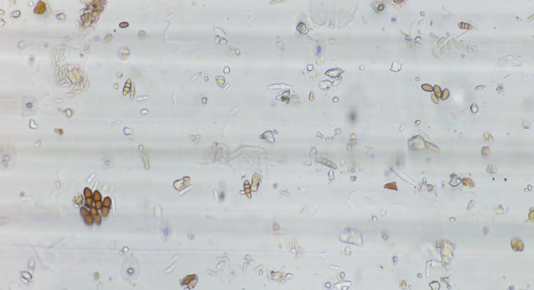 Eutypa and Botryosphaeria Models