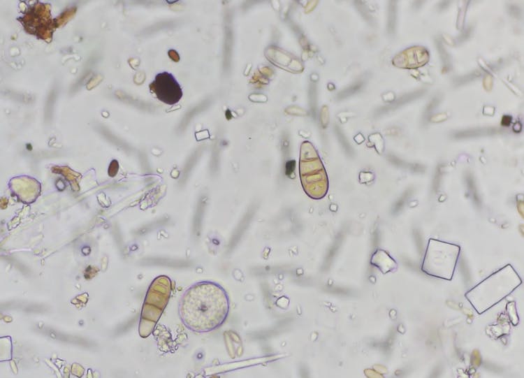 Understanding Silver Scurf Disease in Potatoes and the Role of Agtech in Its Management