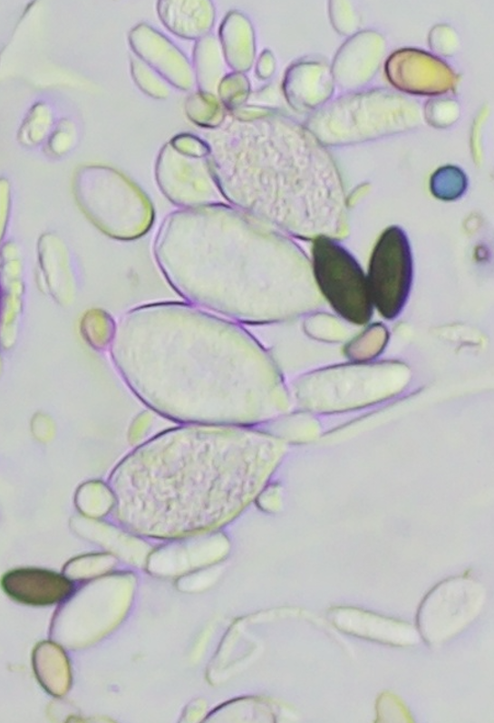 Grape Downy Mildew 2