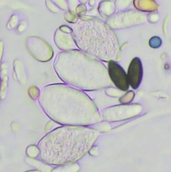 Grape Downy Mildew 2