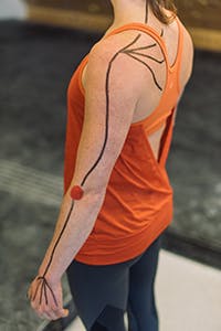 lines showing muscles affected by tennis elbow 