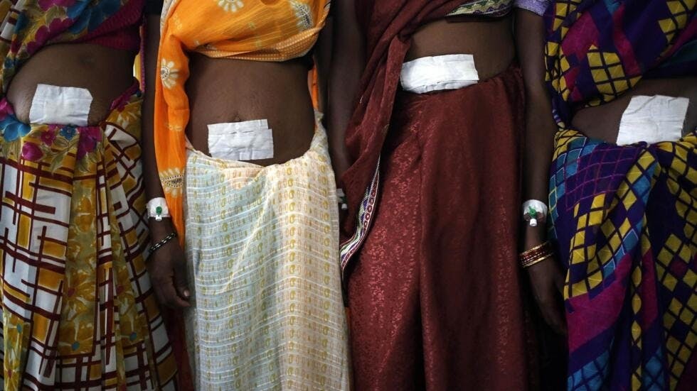 Mujeres que participan en esterilizaciones masivas en India.