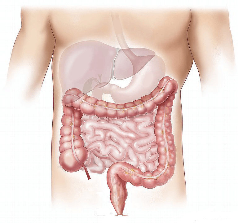 Can type 2 diabetes be reversed?