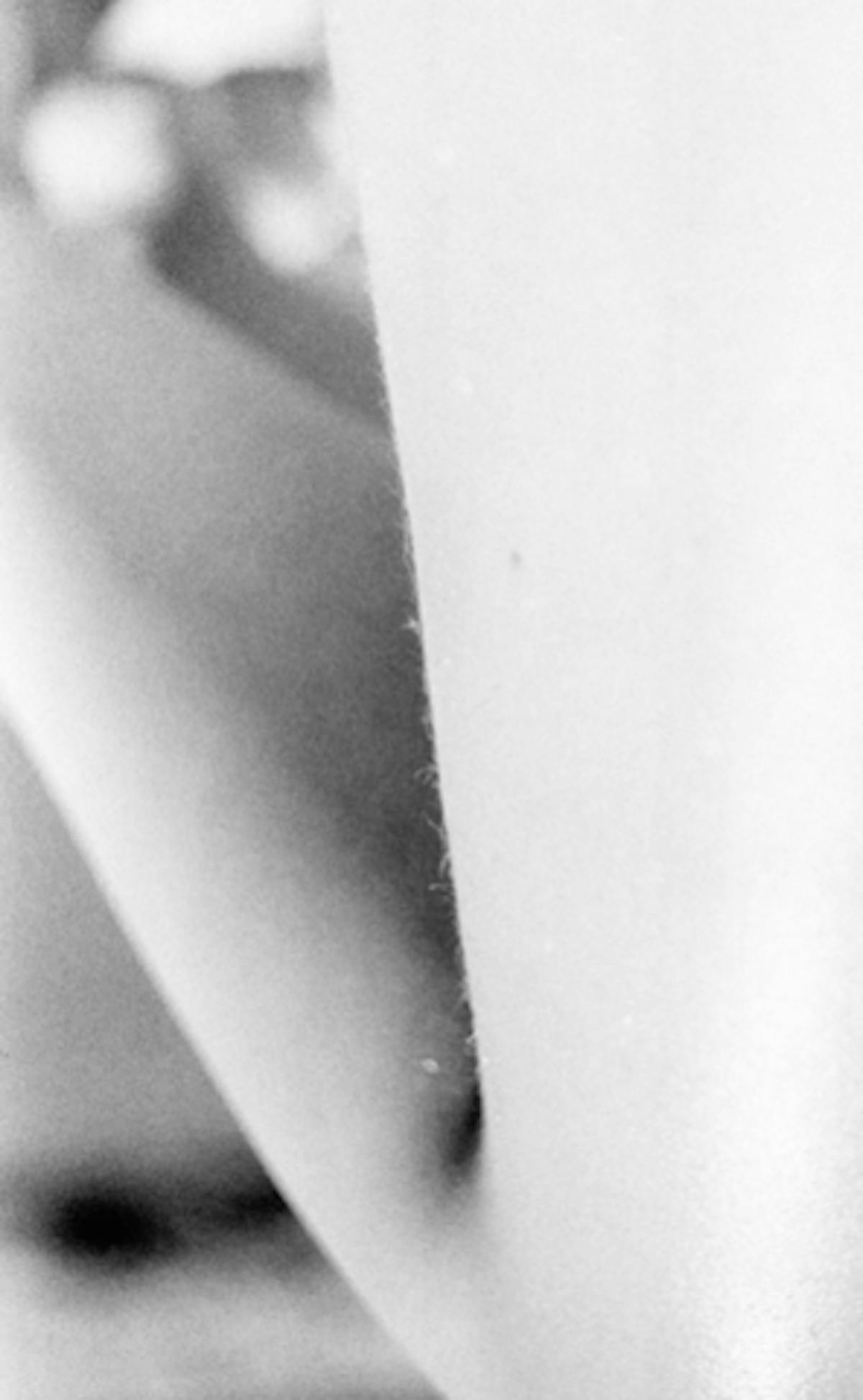 Picture of an arm