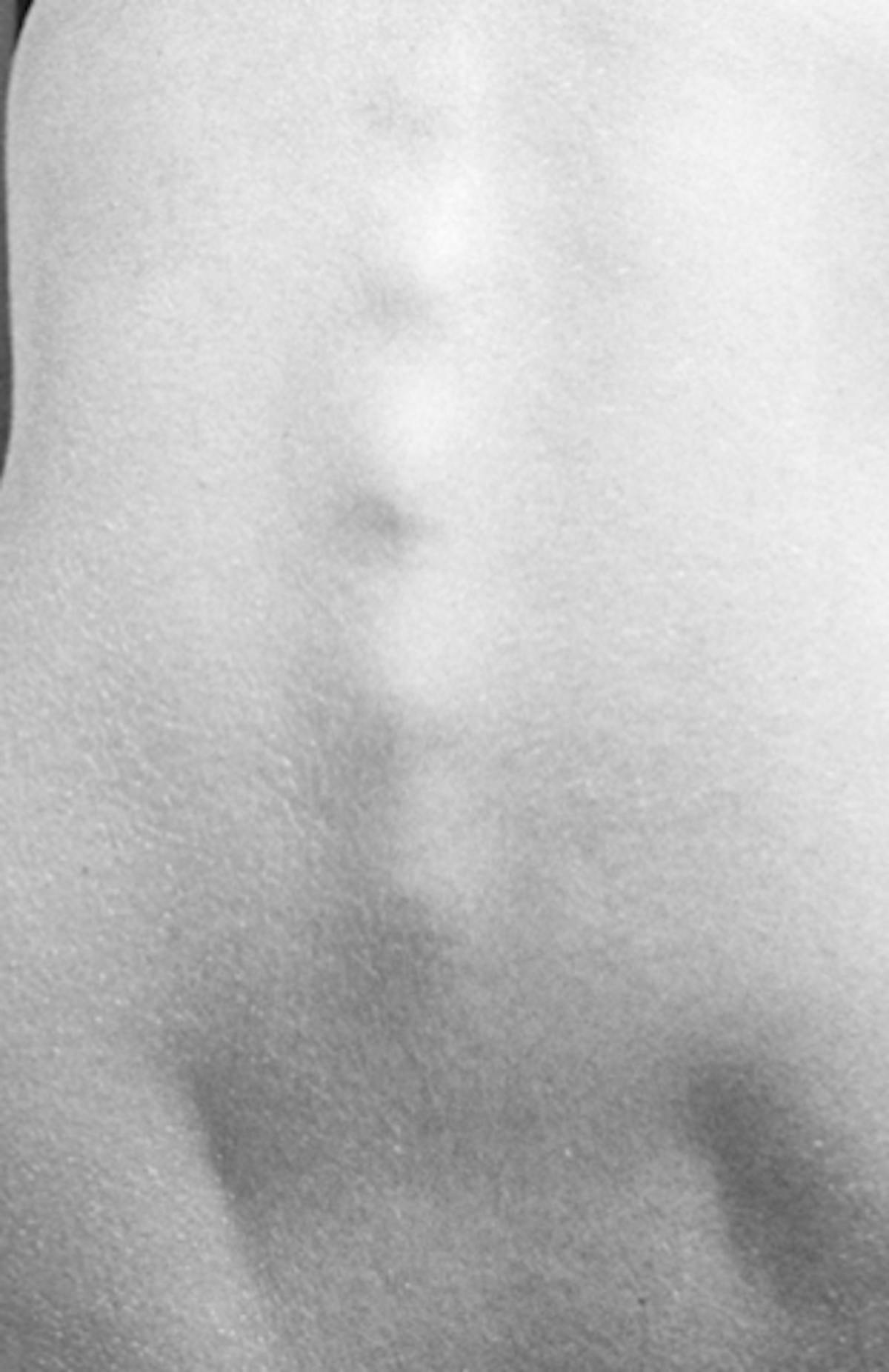 Picture in black and white of a bodypart