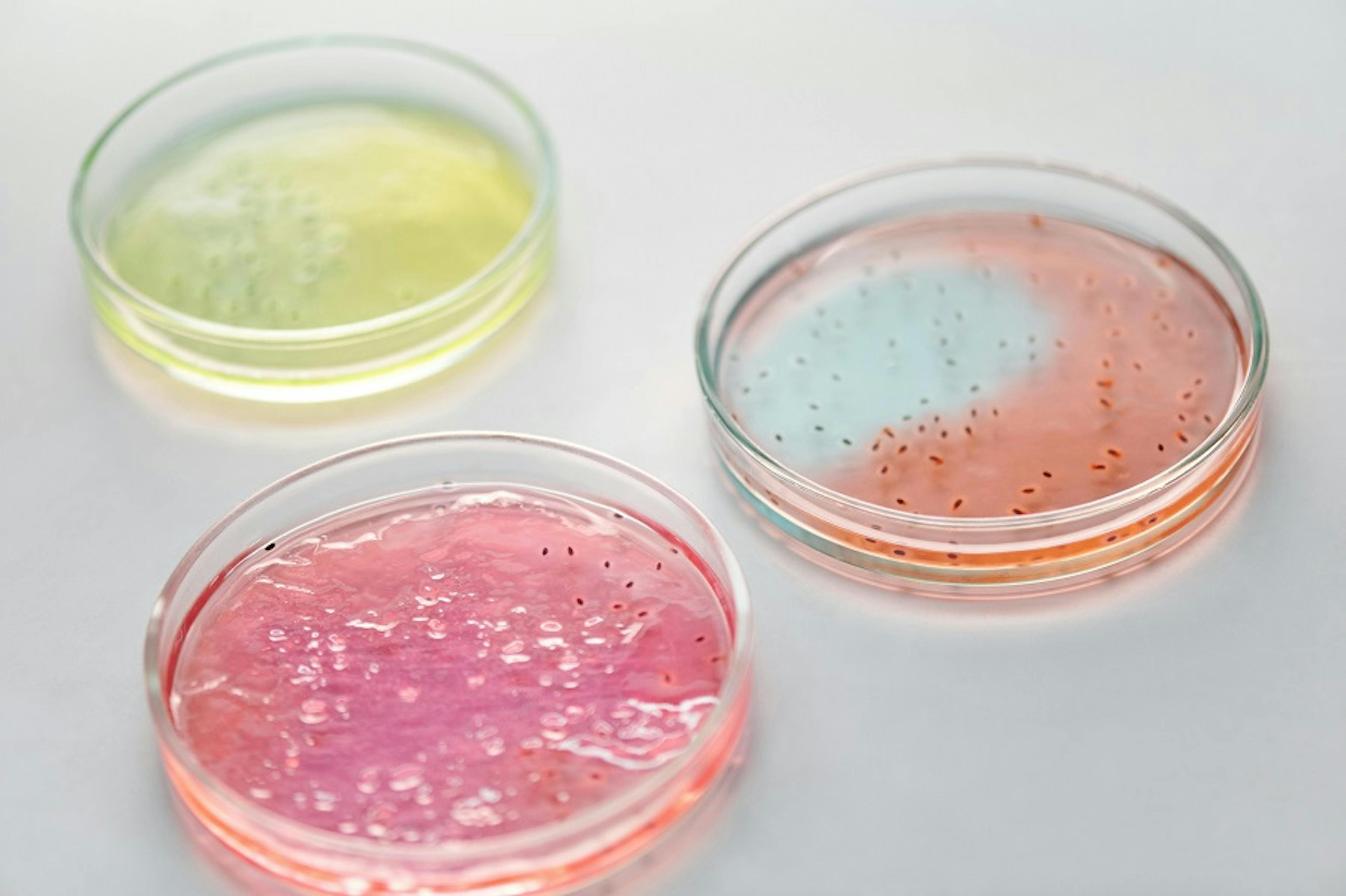 antimikrobiální rezistence, boiron, laborator, petriho miska, bakterie