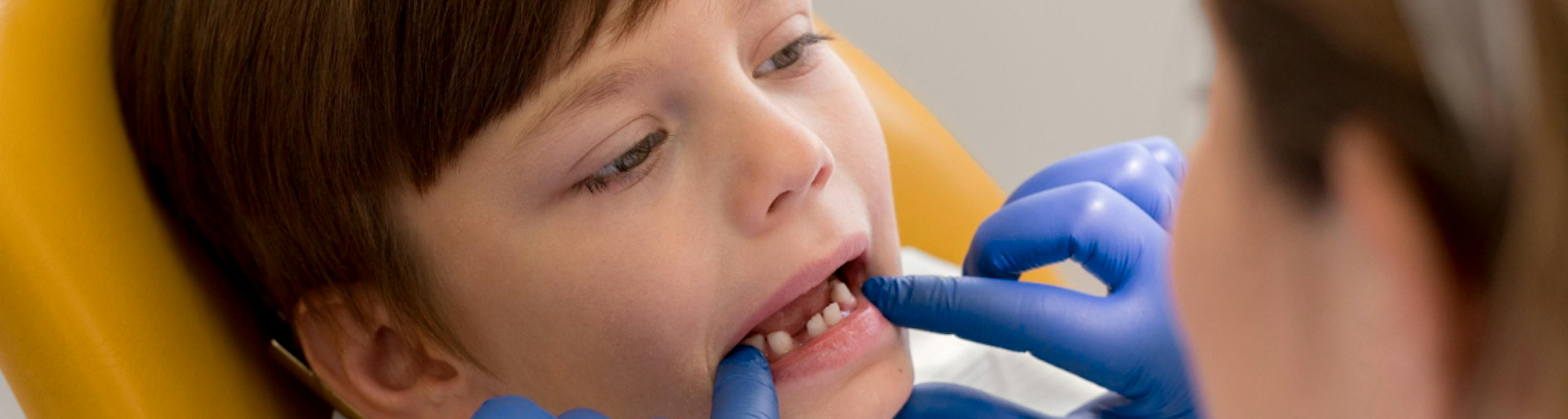 Dientes de leche niño