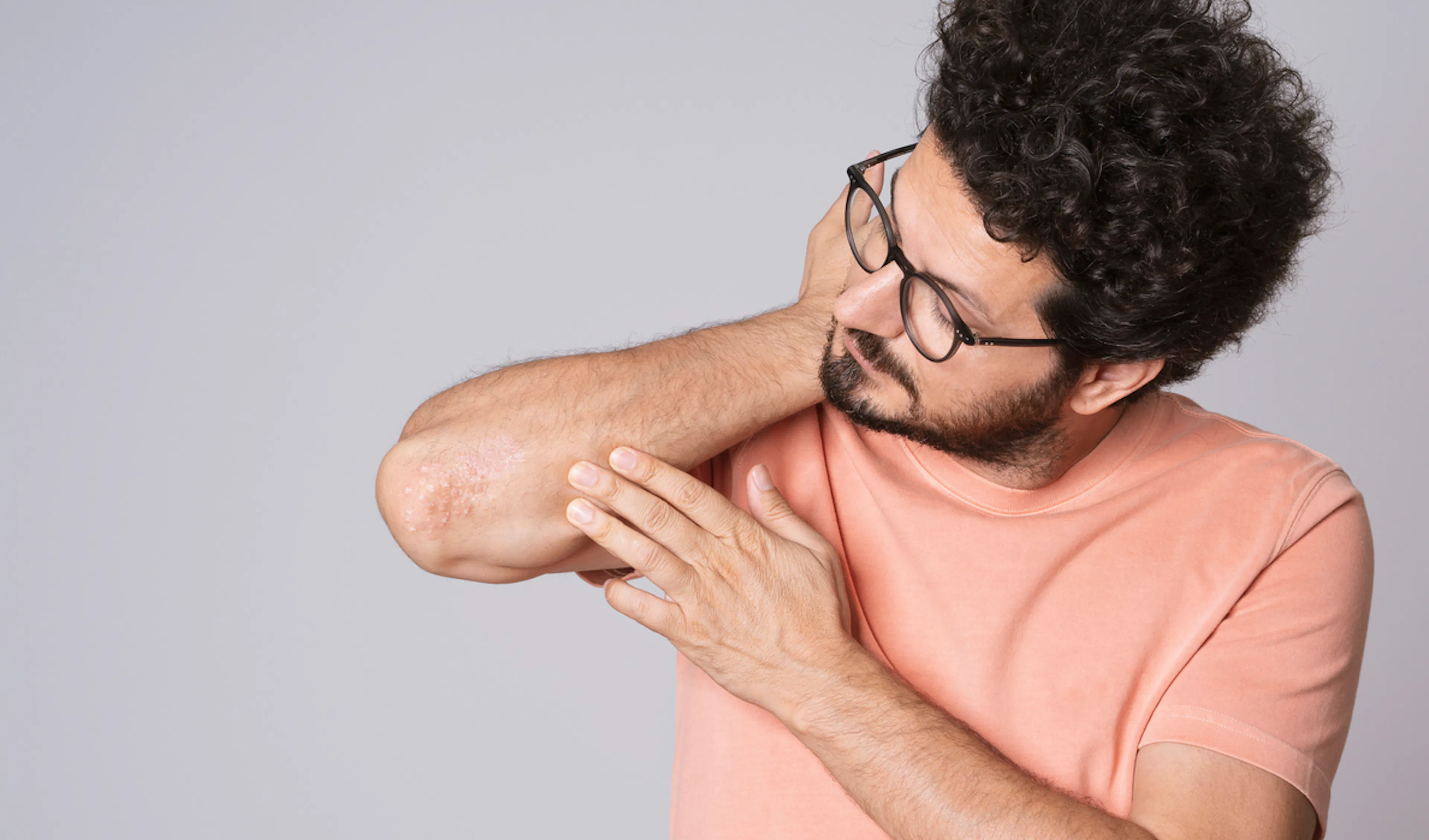 Uomo si si guarda il gomito dove ha uno sfogo di psoriasi 