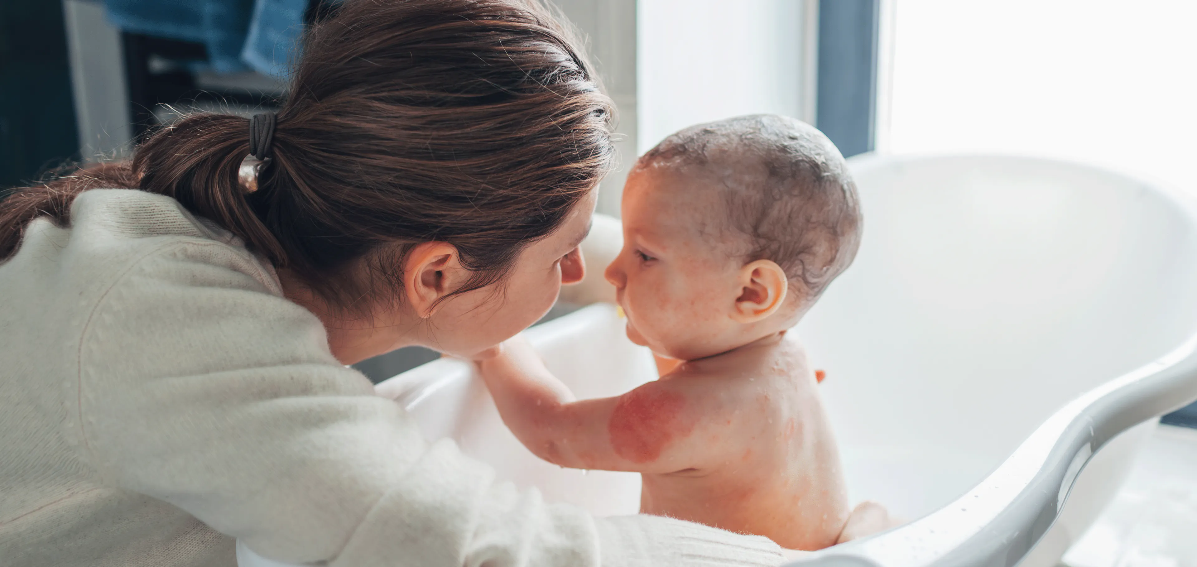 eczéma enfant homéopathie