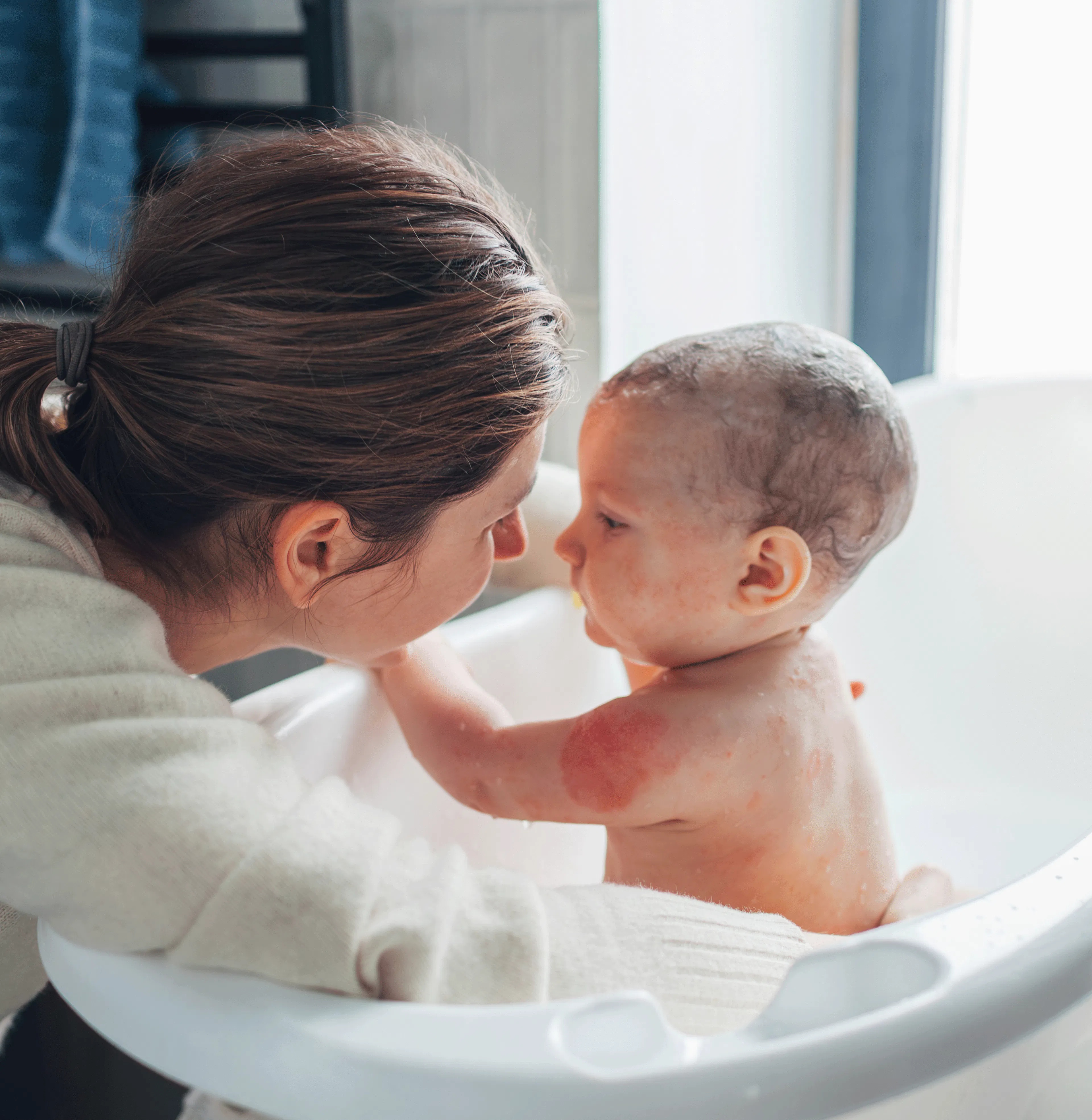 eczéma enfant homéopathie