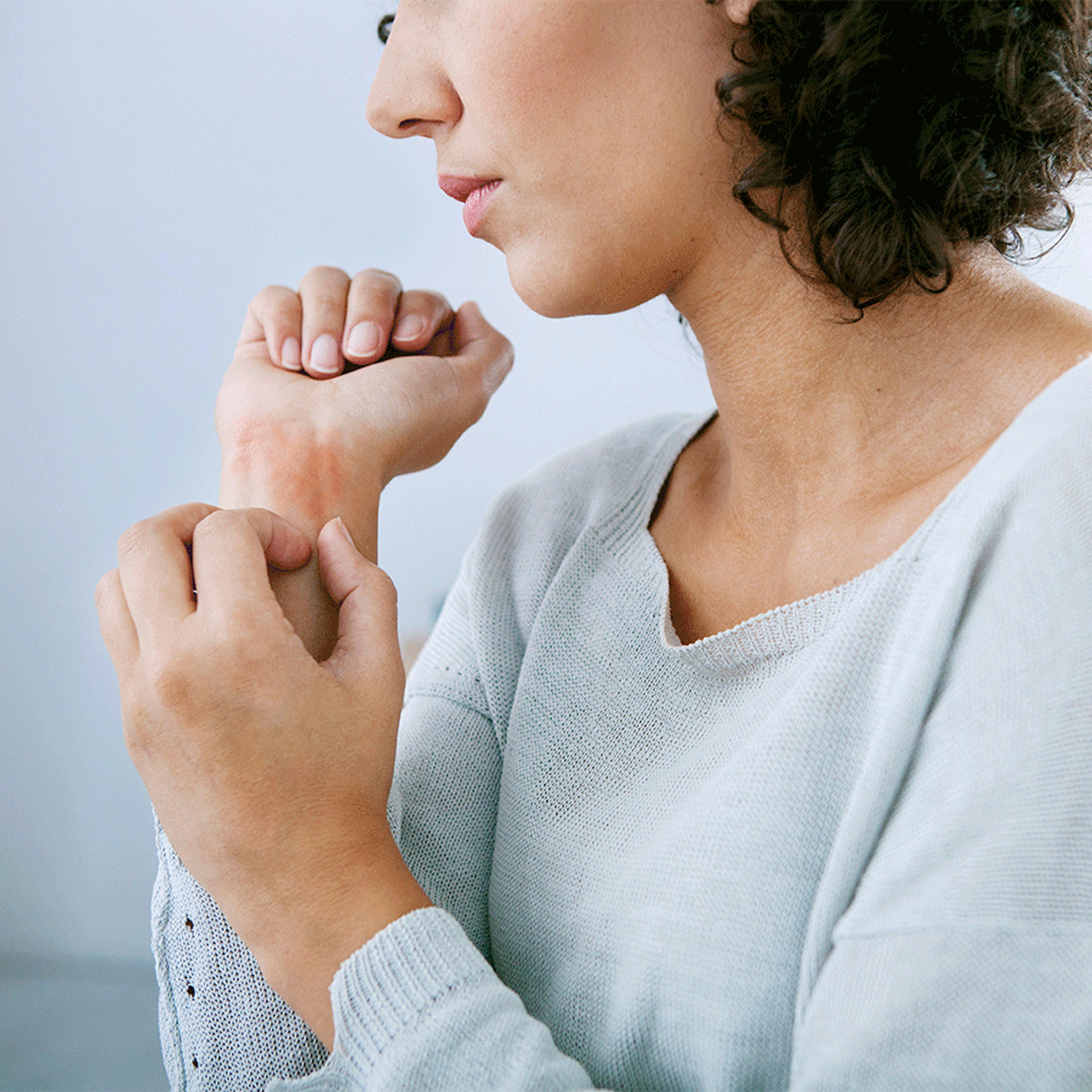 crise urticaire homéopathie