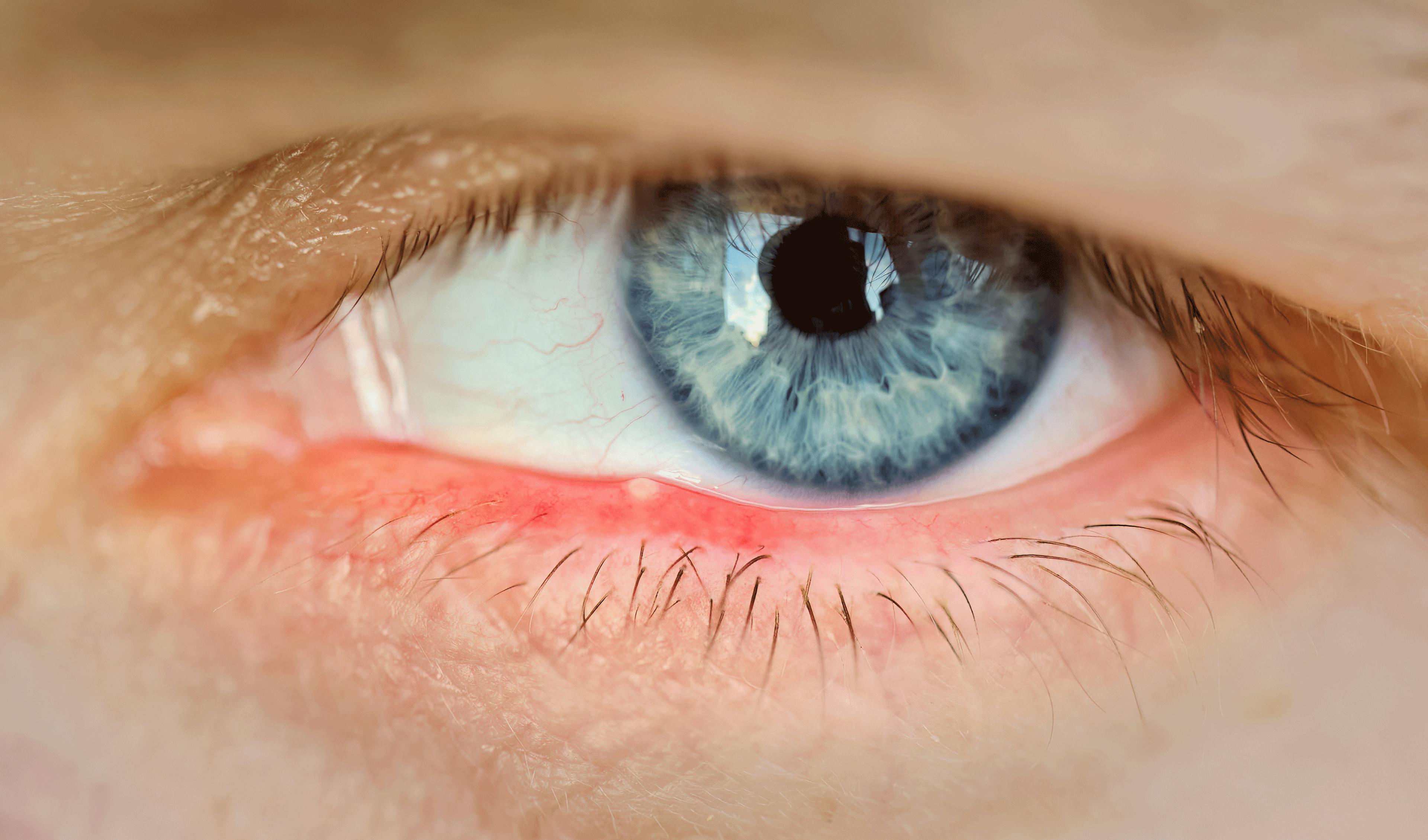 réduire orgelet boiron