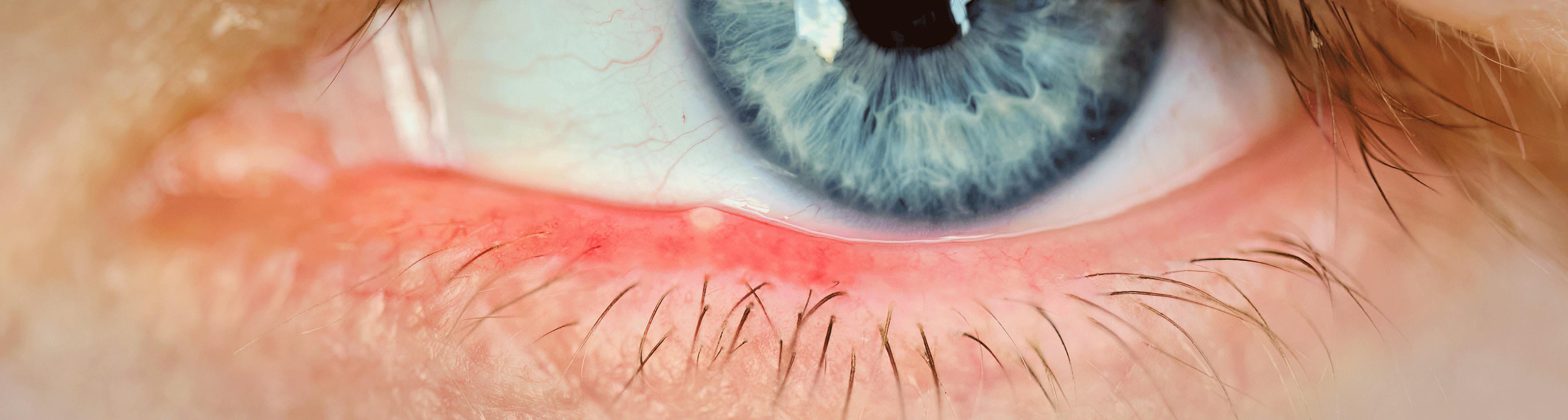 réduire orgelet boiron