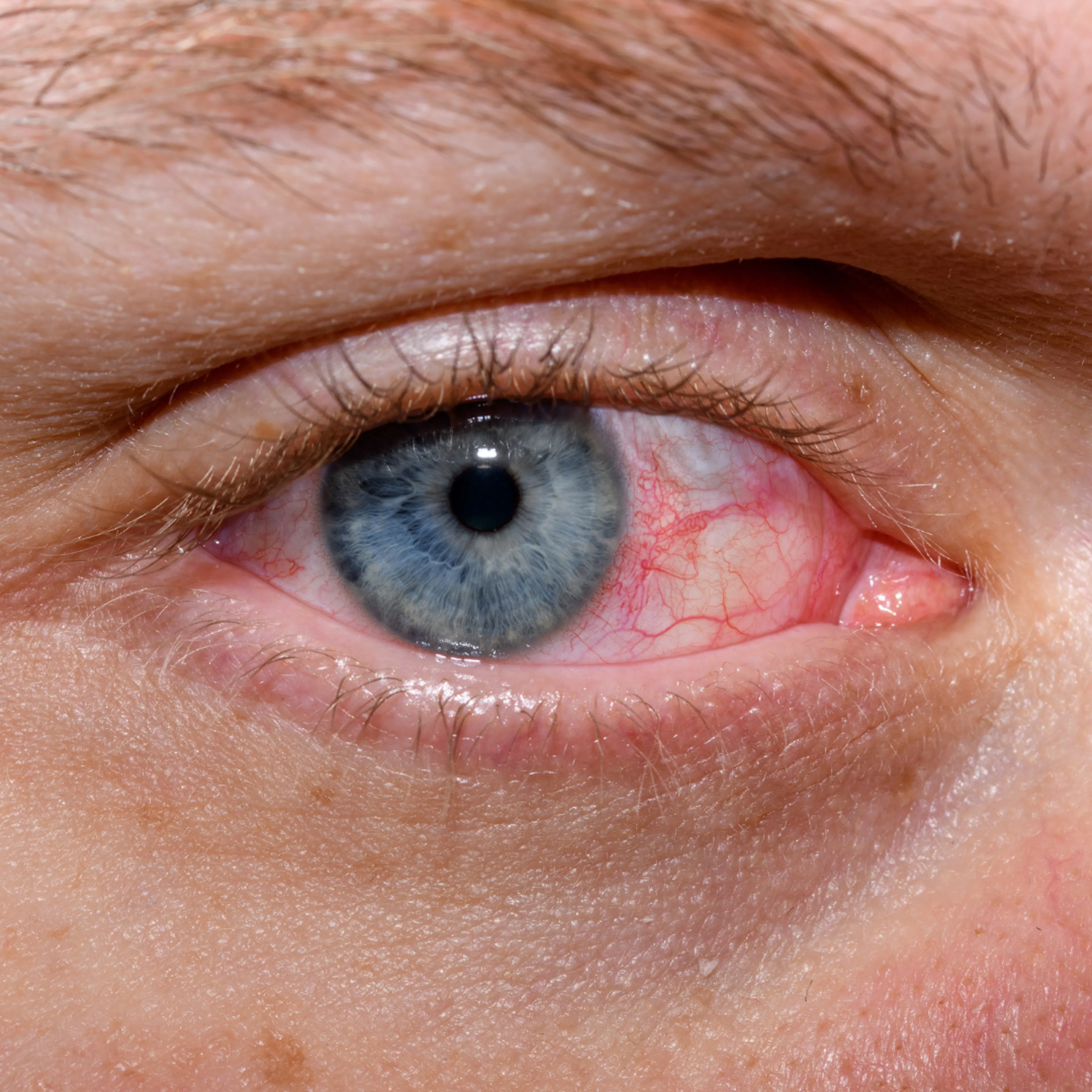 Hooikoortskalender en bloeiperiodes 