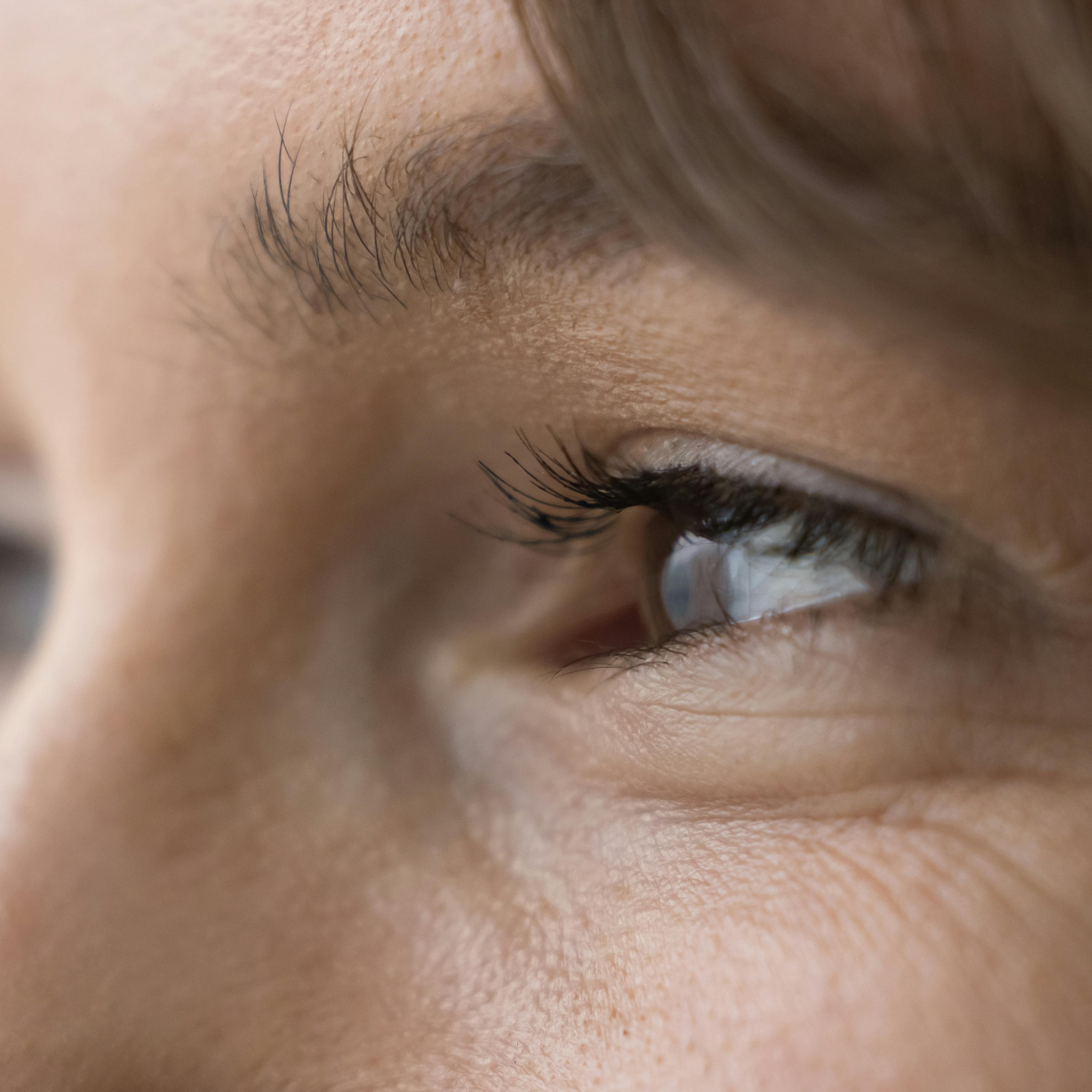 solutions naturelles pour soulager la sécheresse oculaire 