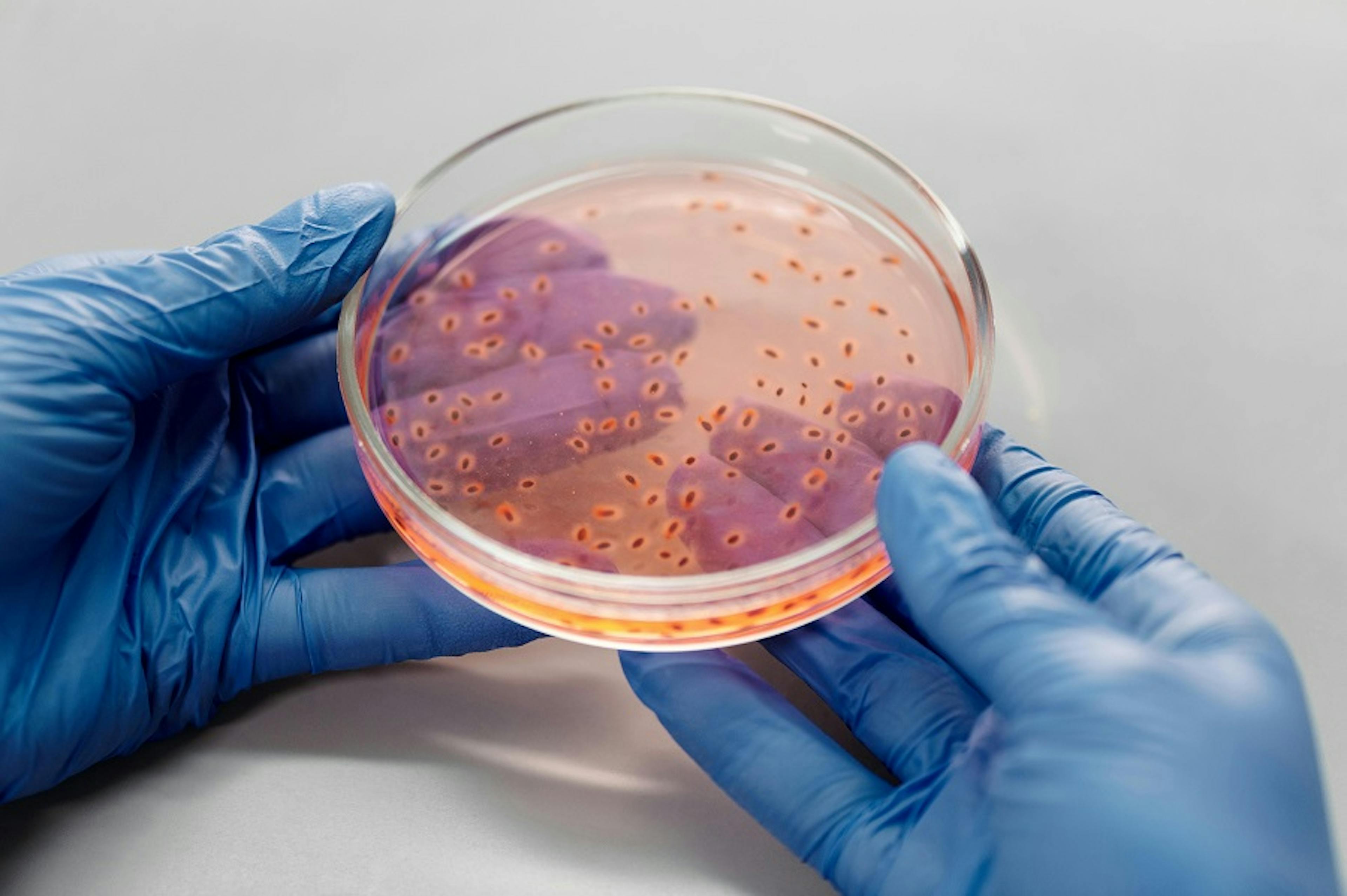 antimikrobiální rezistence, boiron, laborator, petriho miska, bakterie